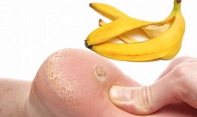 Vassoio di banana per il trattamento di una fattoria plantare