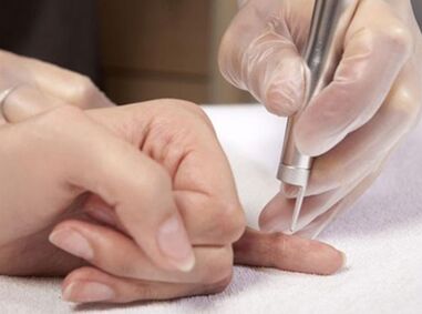 Effettuare la laserterapia