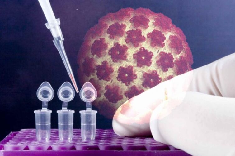 Diagnosi di papillomi