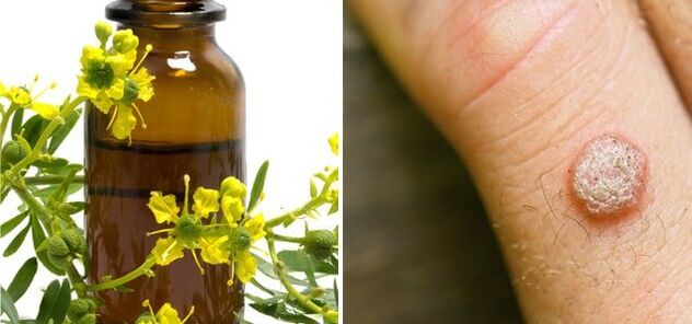 Trattamento delle verruche con celidonia farmaceutica